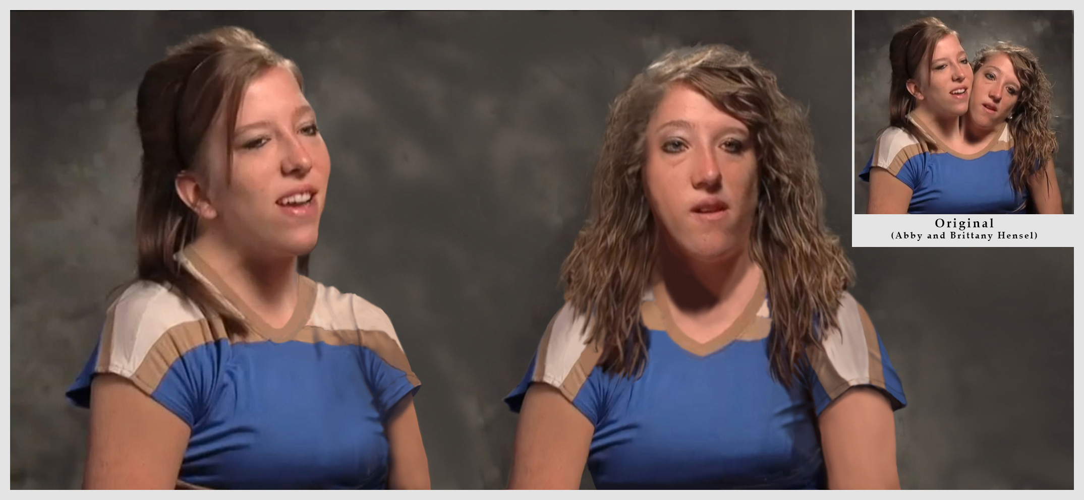 What Conjoined Twins Abby And Brittany Hensel Look Li - vrogue.co